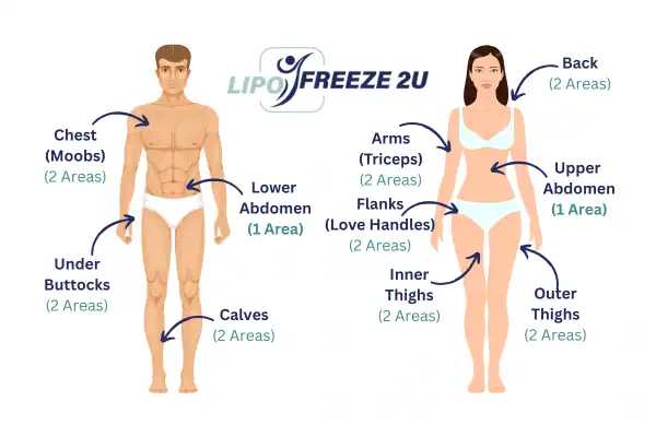 Areas you can have fat freezing treatment Bexhill