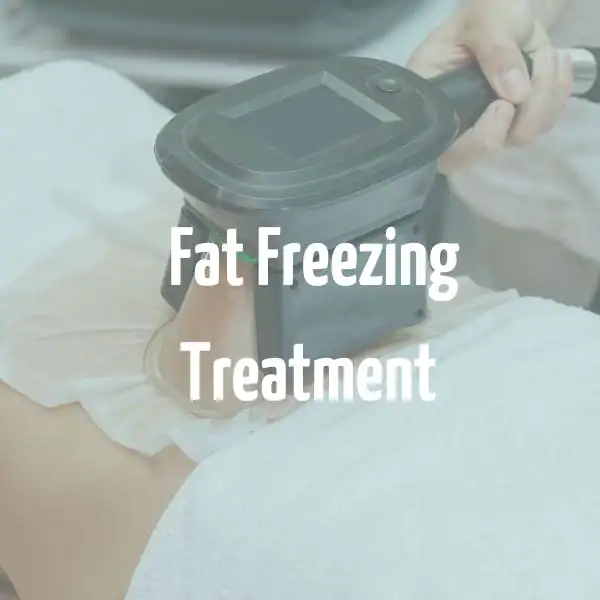 fat freezing treatment Bexhill