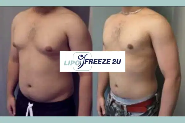 How Long Does It Take to See Results Bexhill?