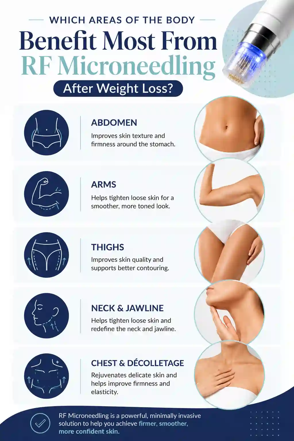 Which Areas of the Body Benefit Most From RF Microneedling After Weight Loss Bexhill